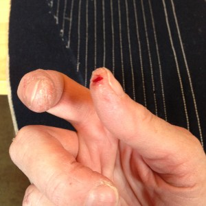 d'oh! surgical tape made this *much* better later.